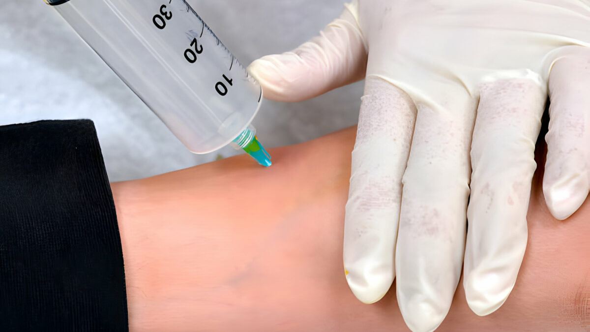 7 Common Questions About Ozone Injection Therapy Answered