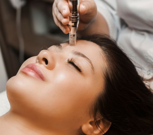 Microneedling services